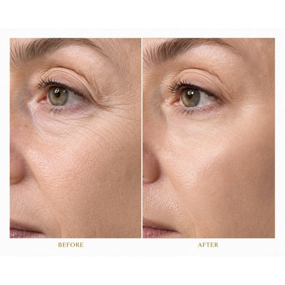 Sorellè fine line & wrinkle smoother